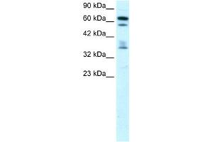 WB Suggested Anti-ZNF512 Antibody Titration: 0. (ZNF512 anticorps  (Middle Region))
