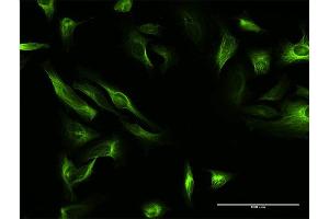 Immunofluorescence of purified MaxPab antibody to MAP7 on HeLa cell. (MAP7 anticorps  (AA 1-749))
