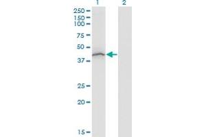 Western Blot analysis of STAT5B expression in transfected 293T cell line by STAT5B monoclonal antibody (M04), clone 1C2.