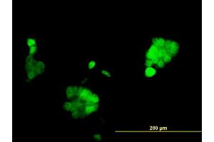 Immunofluorescence of monoclonal antibody to PGR on A-431 cell. (Progesterone Receptor anticorps  (AA 1-110))