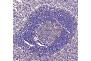 IHC testing of FFPE rat spleen tissue with RAB27A antibody at 1ug/ml. (RAB27A anticorps)