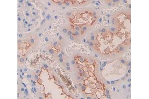 IHC-P analysis of Human Tissue, with DAB staining. (Dysferlin anticorps  (AA 1-479))
