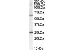 Western Blotting (WB) image for anti-Collagen, Type IV, alpha 3 (Goodpasture Antigen) Binding Protein (COL4A3BP) (AA 662-672) antibody (ABIN293420) (COL4A3BP anticorps  (AA 662-672))