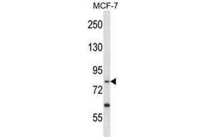 PRKRIR Antibody (N-term) western blot analysis in MCF-7 cell line lysates (35µg/lane). (PRKRIR anticorps  (N-Term))