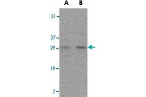 Western blot analysis of TNFSF11 in rat liver tissue lysate with TNFSF11 polyclonal antibody  at (A) 0. (RANKL anticorps  (Internal Region))
