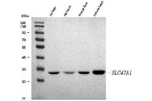 Western blot analysis of MATE-1/SLC47A1 using anti-MATE-1/SLC47A1 antibody (ABIN7599457).