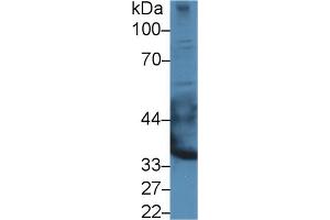Western blot analysis of Rat Heart lysate, using Mouse EPYC Antibody (3 µg/ml) and HRP-conjugated Goat Anti-Rabbit antibody ( (EPYC anticorps  (AA 130-322))