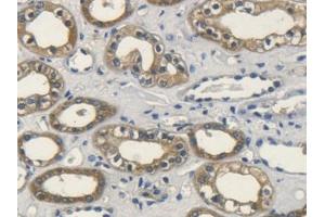 DAB staining on IHC-P; Samples: Human Kidney Tissue