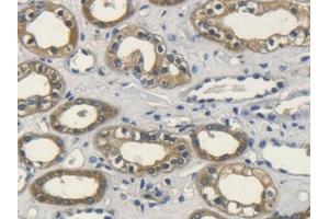 DAB staining on IHC-P; Samples: Human Kidney Tissue (FGF10 anticorps  (AA 38-208))
