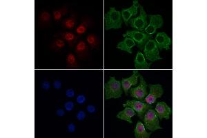 ABIN6264703 and ABIN6269101 staining HepG2 cells by IF/ICC. (Retinoblastoma Protein (Rb) anticorps  (C-Term))