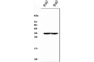 Western blot analysis of CD79b using anti-CD79b antibody (ABIN7601115).