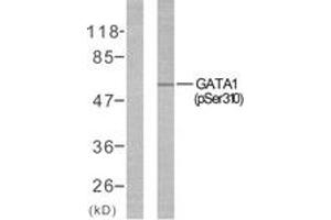 Western blot analysis of extracts from COS7 cells treated with EPO, using GATA1 (Phospho-Ser310) Antibody. (GATA1 anticorps  (pSer310))