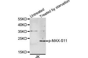 Western Blotting (WB) image for anti-MYC Associated Factor X (MAX) (pSer11) antibody (ABIN3019515) (MAX anticorps  (pSer11))