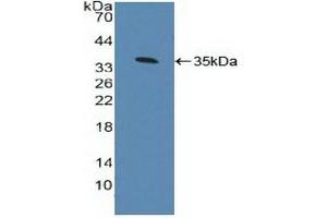 Detection of Recombinant AhR, Human using Polyclonal Antibody to Aryl Hydrocarbon Receptor (AhR)