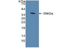 Detection of Recombinant AhR, Human using Polyclonal Antibody to Aryl Hydrocarbon Receptor (AhR) (Aryl Hydrocarbon Receptor anticorps  (AA 128-399))