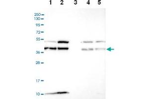 Western blot analysis of Lane 1: RT-4 Lane 2: U-251 MG Lane 3: Human Plasma Lane 4: Liver Lane 5: Tonsil with C6orf47 polyclonal antibody ( Cat # PAB28310) at 1:100-1:250 dilution. (C6orf47 anticorps)