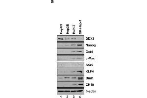 DDX3 suppresses stemness gene signature.