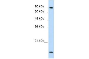 WB Suggested Anti-UBE2L3 Antibody Titration:  1. (UBE2L3 anticorps  (C-Term))