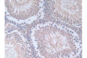 Detection of FN in Rat Testis Tissue using Polyclonal Antibody to Fibronectin (FN)