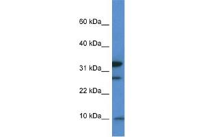 WB Suggested Anti-Mrps33 Antibody Titration: 1. (MRPS33 anticorps  (Middle Region))