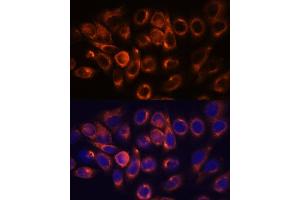 Immunofluorescence analysis of HeLa cells using  antibody (ABIN7265713) at dilution of 1:100. (ATL2 anticorps  (AA 390-470))