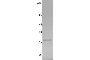 Western Blotting (WB) image for TGF-beta Activated Kinase 1/MAP3K7 Binding Protein 1 (TAB1) (AA 1-200) protein (His tag) (ABIN7125344)