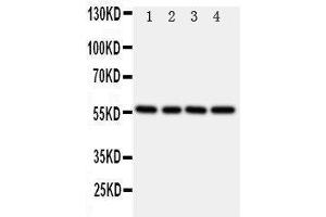 Anti-TXNRD2 antibody, Western blotting Lane 1: Rat Kidney Tissue Lysate Lane 2: Rat Ovary Tissue Lysate Lane 3: Rat Liver Tissue Lysate Lane 4: SMMC Cell Lysate (TXNRD2 anticorps  (C-Term))