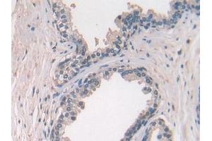 Used in DAB staining on fromalin fixed paraffin-embedded Ovary tissue