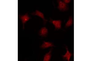 ABIN6267254 staining COS7 by IF/ICC. (ABL1 anticorps  (pTyr245))