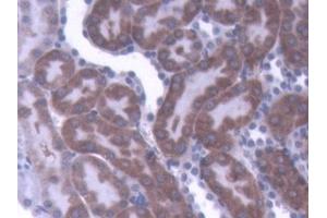 DAB staining on IHC-P; Samples: Rat Kidney Tissue (IL-1 beta anticorps  (AA 117-268))