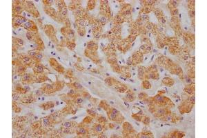 IHC image of ABIN7127317 diluted at 1:100 and staining in paraffin-embedded human liver tissue performed on a Leica BondTM system. (Recombinant ABAT anticorps)