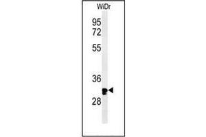 Western blot analysis of HCCS / CCHL Antibody (Center) in WiDr cell line lysates (35ug/lane).