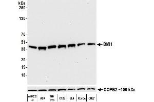 Western Blotting (WB) image for anti-BMI1 Polycomb Ring Finger Oncogene (BMI1) (AA 250-300) antibody (ABIN7455106)
