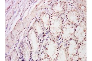 Formalin-fixed and paraffin embedded rat intestine labeled with Anti-DDB2 Polyclonal Antibody, Unconjugated  at 1:300 followed by conjugation to the secondary antibody and DAB staining.