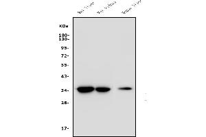 Western blot analysis of EIF2B1 using anti-EIF2B1 antibody (ABIN7602821).