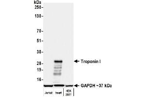 Western Blotting (WB) image for anti-Troponin I (TNNI) (AA 1-50) antibody (ABIN7795680)