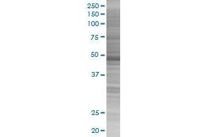 KRT17 transfected lysate. (KRT17 293T Cell Transient Overexpression Lysate(Denatured))
