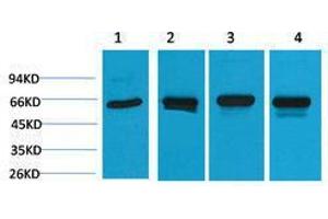 Western Blotting (WB) image for anti-Heat Shock 60kDa Protein 1 (Chaperonin) (HSPD1) antibody (ABIN3181507) (HSPD1 anticorps)