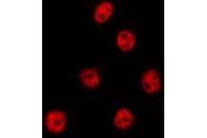 ABIN6275019 staining Hela by IF/ICC. (CSTF2T anticorps  (N-Term))