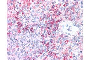 Anti-AURKB / Aurora-B antibody IHC of human spleen. (Aurora Kinase B anticorps  (AA 227-238))