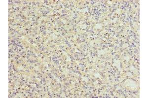 Immunohistochemistry of paraffin-embedded human spleen tissue using ABIN7147031 at dilution of 1:100 (CATSPER2 anticorps  (AA 5-112))