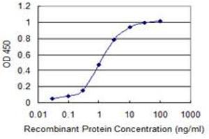 Detection limit for recombinant GST tagged LMTK3 is 0. (LMTK3 anticorps  (AA 1151-1250))