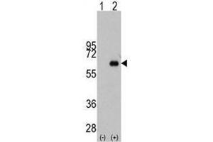 Image no. 1 for anti-Myc Proto-Oncogene protein (MYC) antibody (ABIN357363) (c-MYC anticorps)