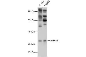 Western blot analysis of extracts of various cell lines, using  antibody (ABIN7265625) at 1:1000 dilution. (Annexin A9 anticorps  (AA 1-100))
