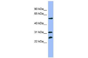 PSMC4 antibody used at 1 ug/ml to detect target protein. (PSMC4 anticorps)