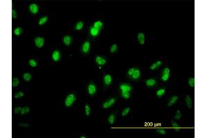 Immunofluorescence of monoclonal antibody to GABPA on HeLa cell. (GABPA anticorps  (AA 1-100))