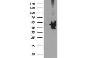Western Blotting (WB) image for anti-Potassium Voltage-Gated Channel, Shaker-Related Subfamily, beta Member 1 (KCNAB1) antibody (ABIN1499001) (KCNAB1 anticorps)