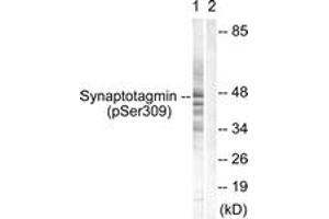 Western blot analysis of extracts from 293 cells treated with Sobital 0. (Synaptotagmin anticorps  (pSer309))