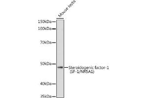 Western blot analysis of extracts of Mouse testis, using Steroidogenic factor-1 (SF-1/NR5) antibody (657) at 1:1000 dilution.