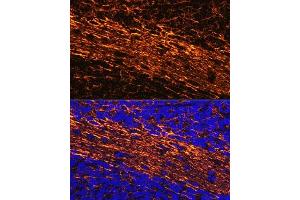 Immunofluorescence analysis of mouse brain using Neurofilament L Rabbit pAb (ABIN3020808, ABIN3020809, ABIN3020810 and ABIN6213733) at dilution of 1:100 (40x lens). (NEFL anticorps  (AA 400-543))